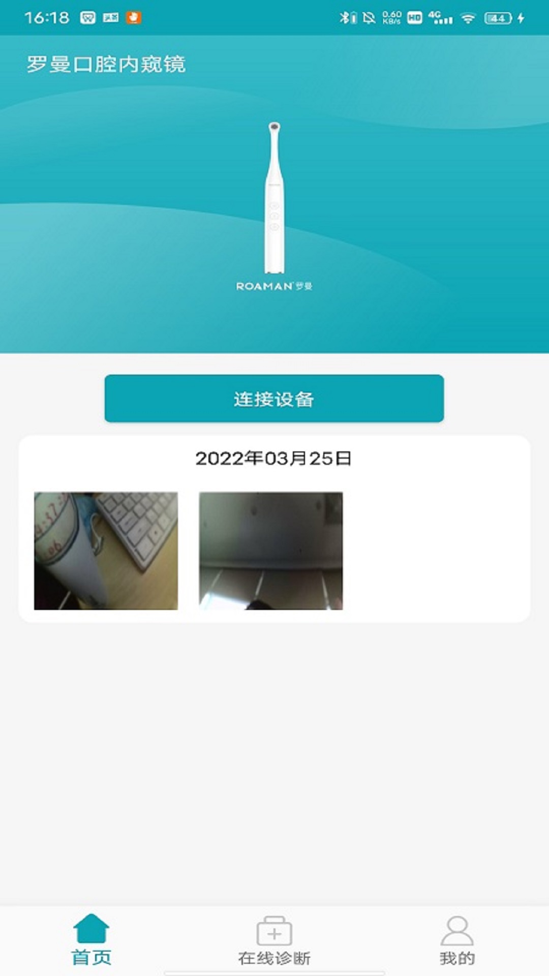 罗曼口腔内窥镜 v1.0.7免费版截图1