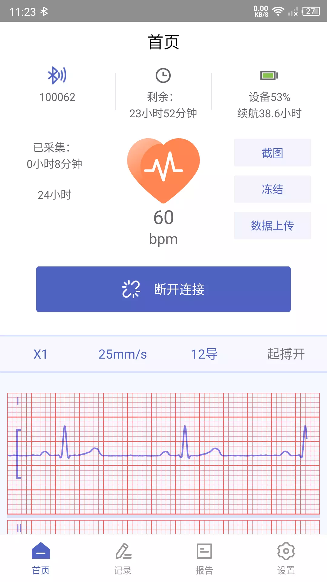 联影小智健康v1.9.9-为您提供方便快捷的心电监测服务截图1
